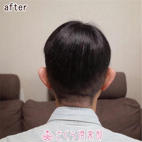 さくら倶楽部 部分ウィッグ メンズ 男性用かつら 人毛100％ Sサイズ