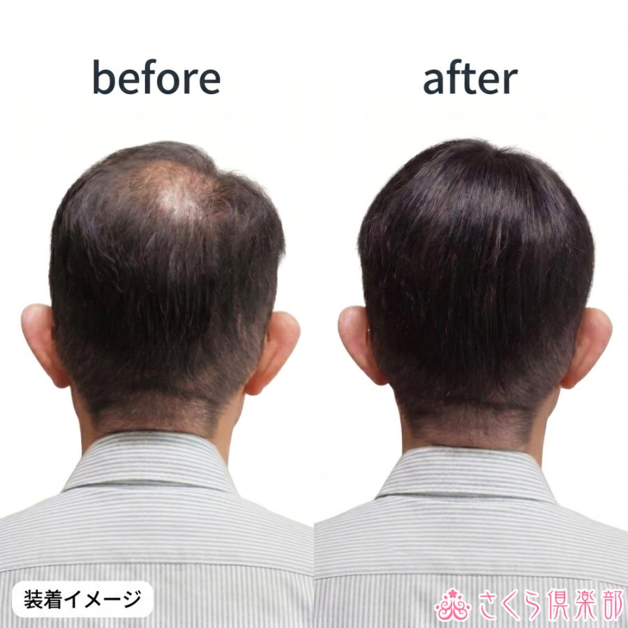 新品　カット調整済み　白髪2％　人毛　24X21㎝　男性部分　かつら さくら倶楽部 男性用メンズ部分ウィッグ人毛100% top-01t Sサイズ 総
