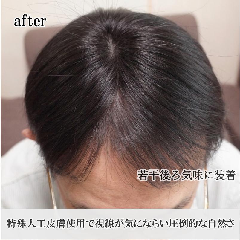 さくら倶楽部 男性用メンズ部分ウィッグ人毛100% 男性かつら top-02n M