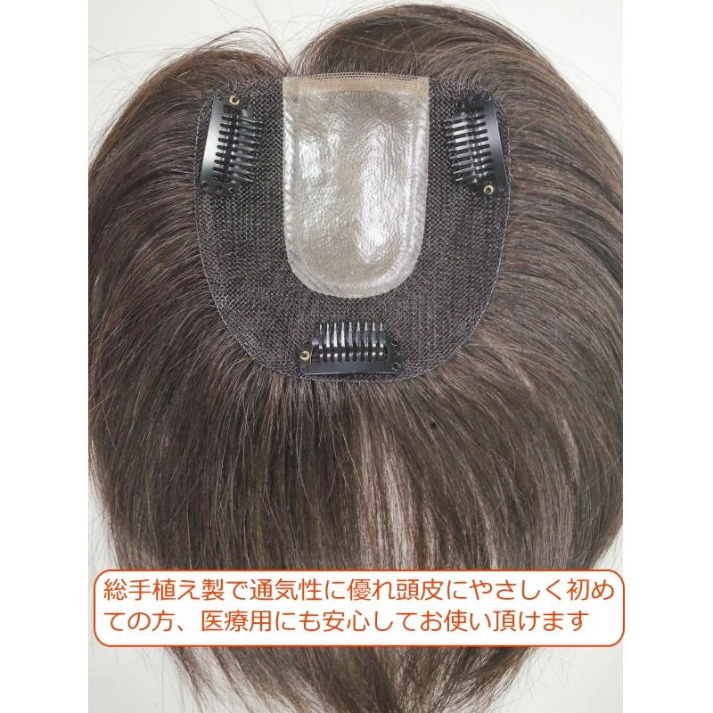 さくら倶楽部 部分ウィッグ メンズ 人毛100% 総手植え製 M さくら倶楽部 部分ウィッグ メンズ 人毛100% 総手植え製 M
