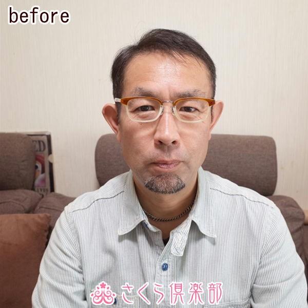 男性用メンズ部分ウィッグ人毛100% top-07 Lサイズ センター分け 総手植え 14×13cm リアル人工皮膚 ナチュラルストレート 白髪隠し 薄毛隠し 男女兼用 軽量の画像