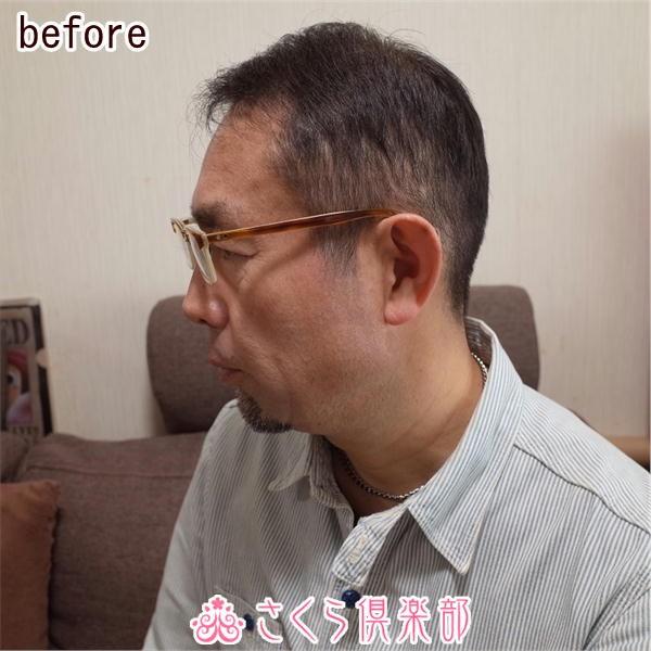 さくら倶楽部 メンズ 部分ウィッグ 部分かつら 人毛100% L さくら倶楽部 メンズ 部分ウィッグ 部分かつら 人毛100% L