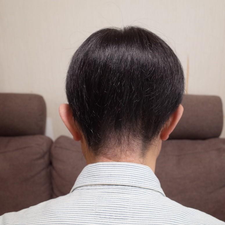 男性用メンズ部分ウィッグ人毛100% top-07 Lサイズ センター分け 総手植え 14×13cm リアル人工皮膚 ナチュラルストレート 白髪隠し 薄毛隠し 男女兼用 軽量の画像
