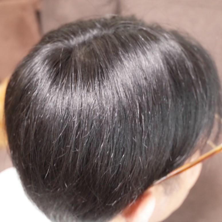 男性用メンズ部分ウィッグ人毛100% top-07 Lサイズ センター分け 総手植え 14×13cm リアル人工皮膚 ナチュラルストレート 白髪隠し 薄毛隠し 男女兼用 軽量の画像