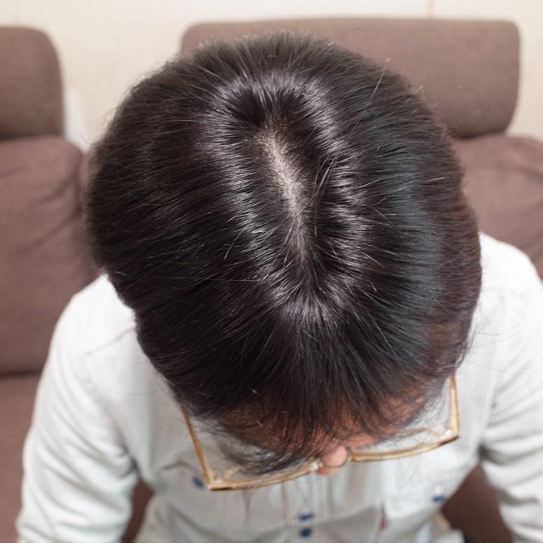さくら倶楽部 メンズ 部分ウィッグ 部分かつら 人毛100% L さくら倶楽部 メンズ 部分ウィッグ 部分かつら 人毛100% L