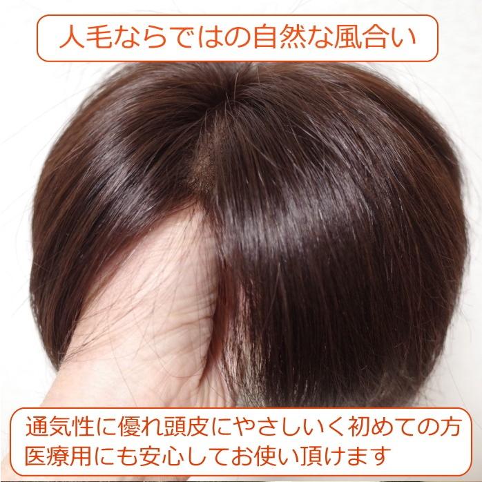 部分ウィッグ 人毛100% 女性 レディース 総手植え Lサイズ top-07 ヘアピース 特殊人工皮膚付き センター分け ストレート 医療用 かつら 自然 軽いの画像