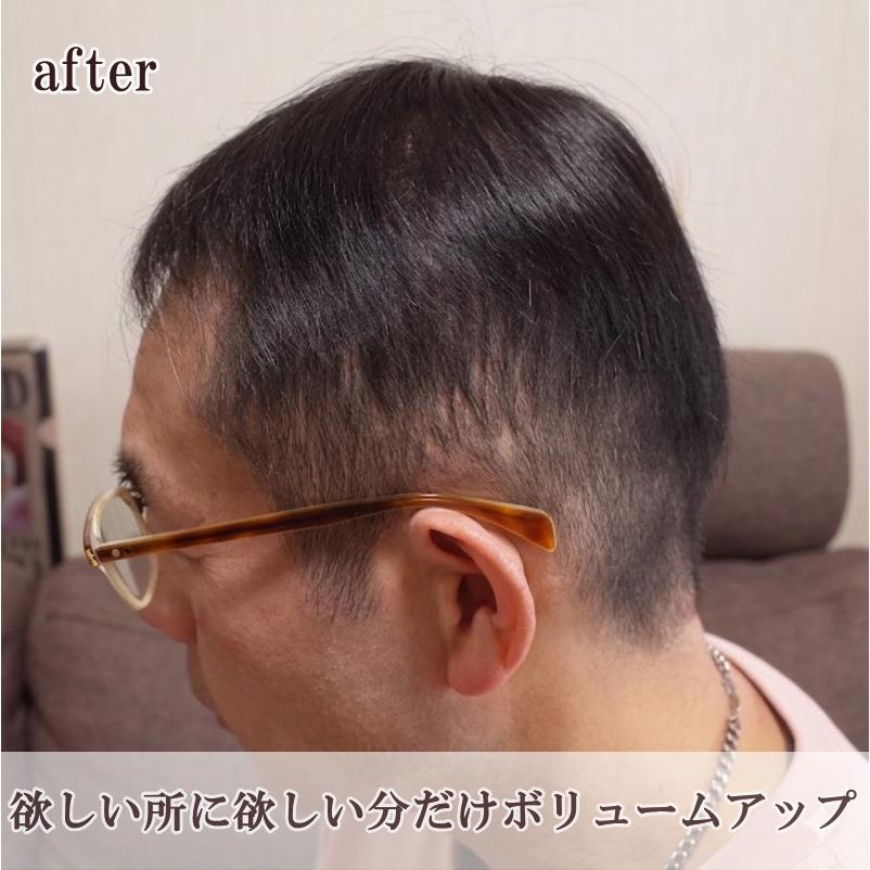 さくら倶楽部 男性用メンズ部分ウィッグ 人毛100% top-s 極小Sサイズ