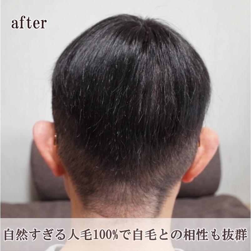 さくら倶楽部 男性用メンズ部分ウィッグ 人毛100% top-s 極小Sサイズ