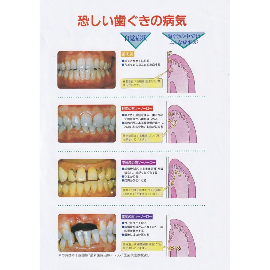 薬用 ソルトぎょくせい 歯周病予防 歯肉炎予防 サンスター 生薬当帰エキス 115g S001 さくら医薬品ストア 通販 Yahoo ショッピング