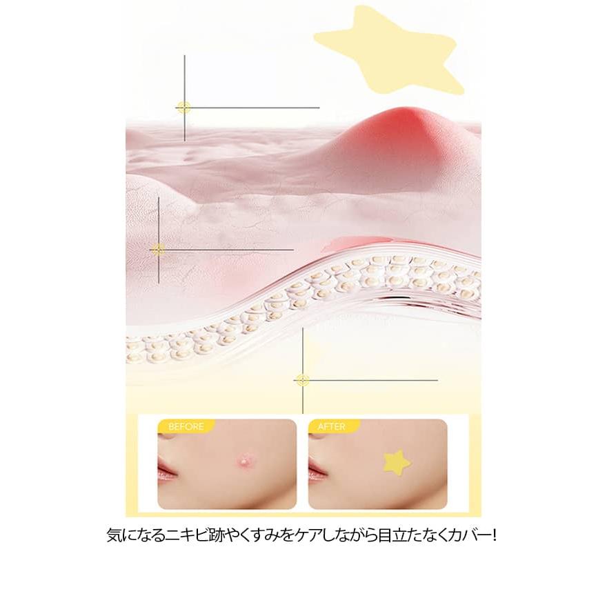 スポットパッチ ニキビパッチ スポットエイド かわいい 星型