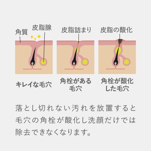 ピーリング石鹸 ニキビ予防 ピールソープ AHA 1.5% レチノール グリコール酸配合 赤 100g オイル 脂性肌 角質 ピーリング石鹸 洗顔石けん ビタミンA誘導体 | プラスキレイ | 07