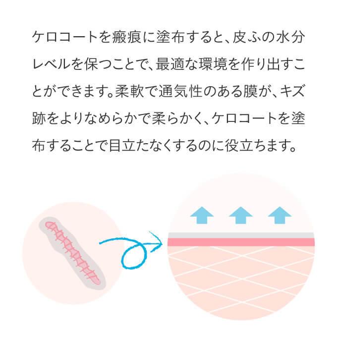 ケロコート 6g 3個セット 国内正規流通品 ニキビ跡 傷跡に 皮膚保護ジェル 傷跡専用 シリコンジェル |  | 05