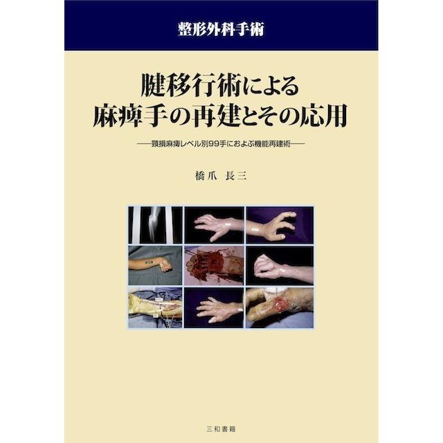 腱移行術による麻痺手の再建とその応用｜sanwa-co