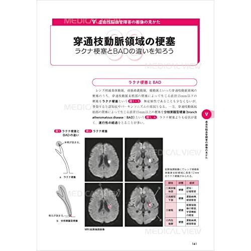 コツさえわかればあなたも読める リハに役立つ脳画像?改訂第2版｜sapphire98｜02