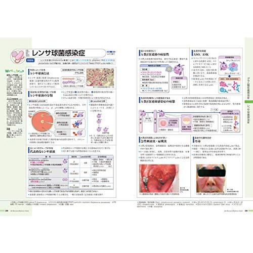 病気がみえる vol.6 免疫・膠原病・感染症｜sapphire98｜06