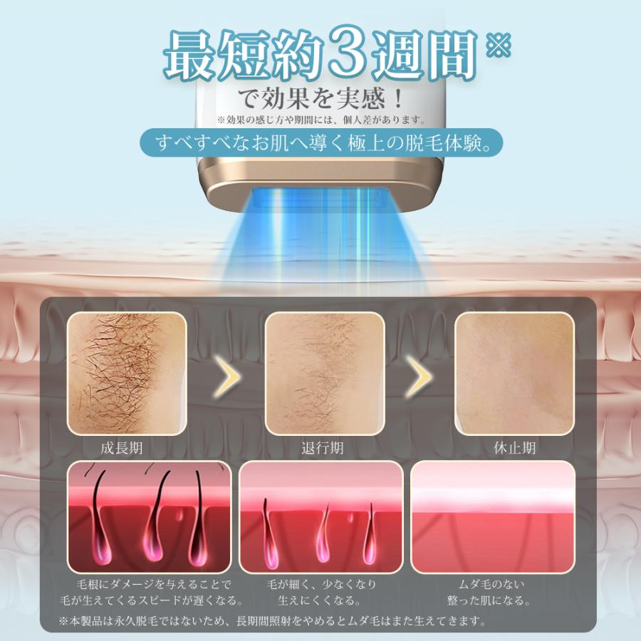 脱毛器 IPL光脱毛器 ムダ毛処理 家庭用 脱毛 光美容器 脱毛ケア 美肌