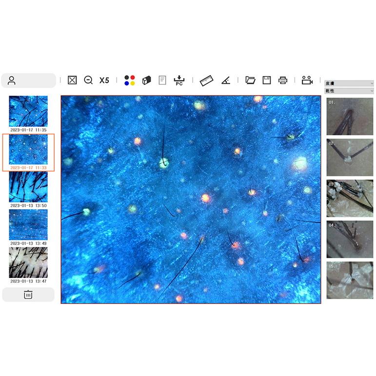 美容マイクロスコープシステムCOMEDO 美容マイクロスコープCOMEDO アクネ菌・皮脂・頭皮診断 Jスコープ は