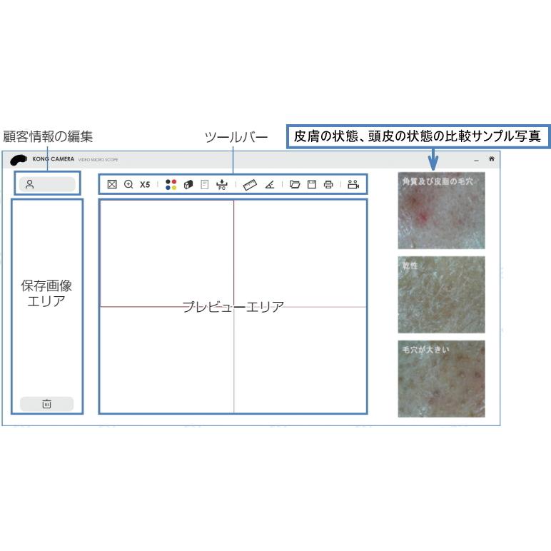 Jスコープ カウンセリングマイクロスコープCOMEDO Pro 肌診断システム