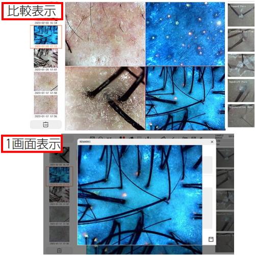 Jスコープ カウンセリングマイクロスコープCOMEDO Pro 肌診断システム