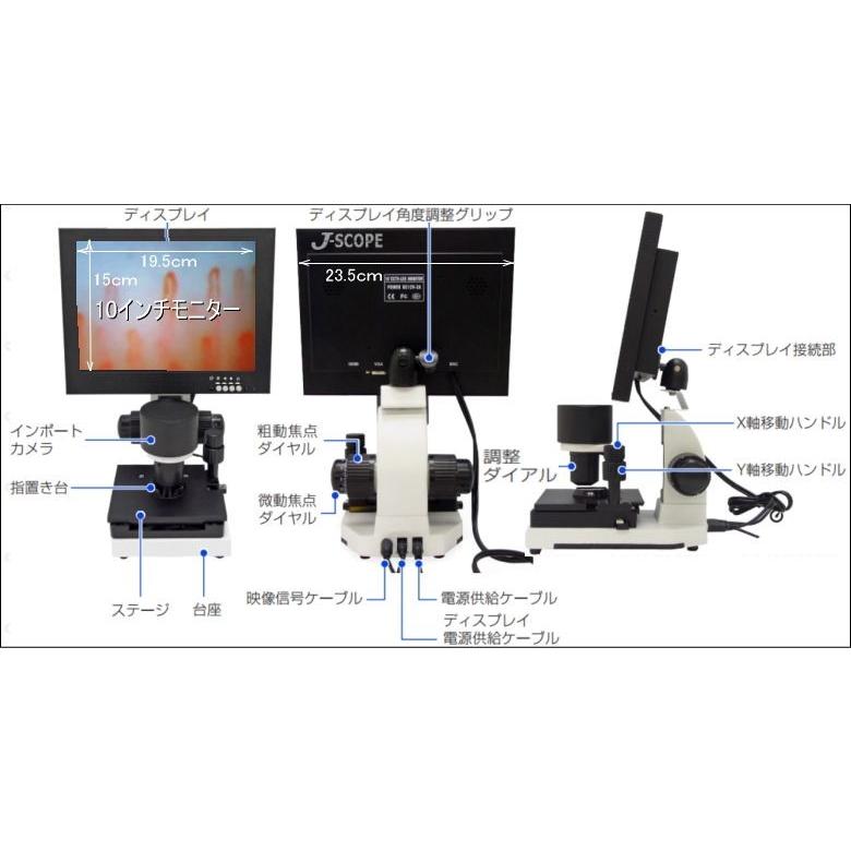 感謝の声続々！ B-Scan Pro 毛細血管スコープ 血流スコープ ゴースト