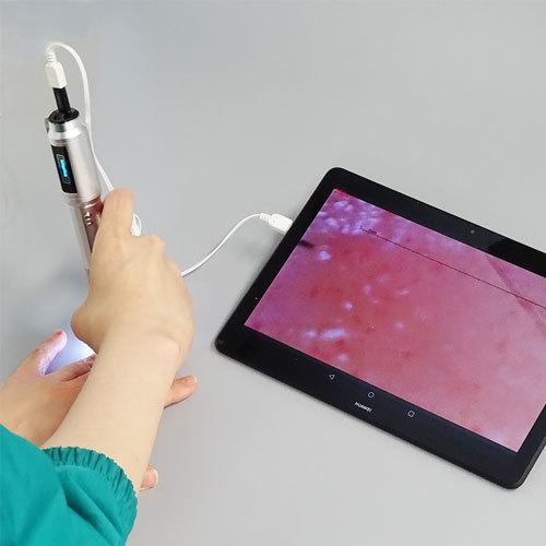 血流観察装置BscanPRO 高性能ハンディ型血流スコープ通信機器 Bscan 商品ページ