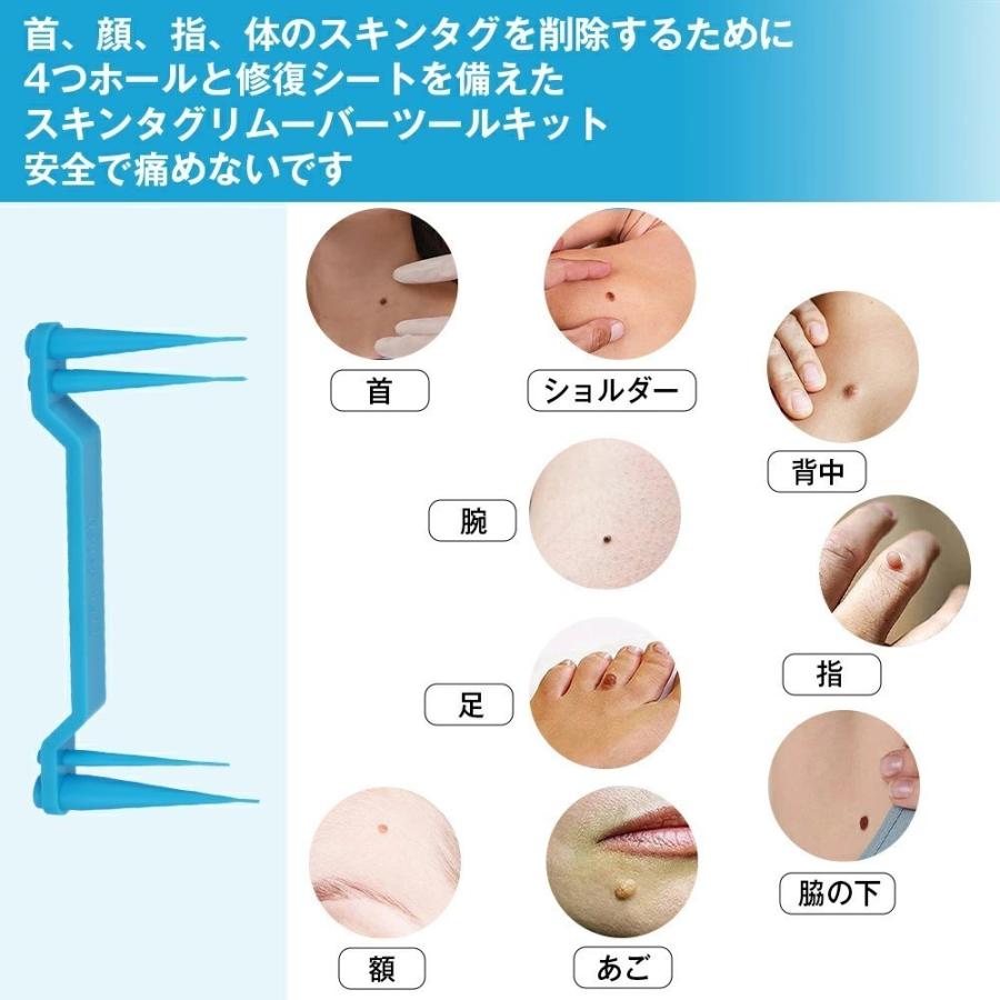 スキンタグリムーバーデバイスキット スキンタグ スキンタグ除去ツールキット ほくろいぼリムーバーパッチ 小型から大型のスキンタグ用 |  | 04