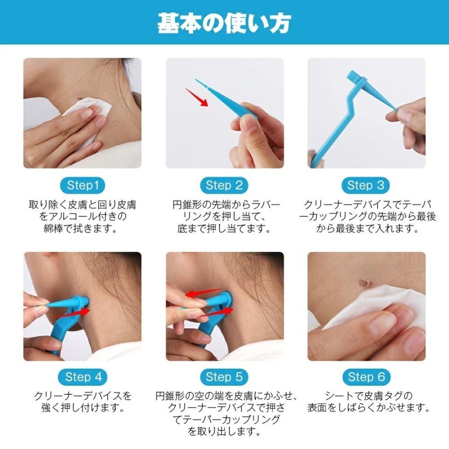 スキンタグリムーバーデバイスキット スキンタグ スキンタグ除去ツールキット ほくろいぼリムーバーパッチ 小型から大型のスキンタグ用 |  | 06