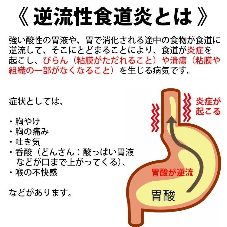 逆流性食道炎 胃酸過多 エスマーゲン 21包 約7日分 食欲不振 胃酸の出すぎ 飲み過ぎ 胸やけ 膨満感 漢方 第2類医薬品 ホノミ Hm サツマ薬局 通販 Yahoo ショッピング