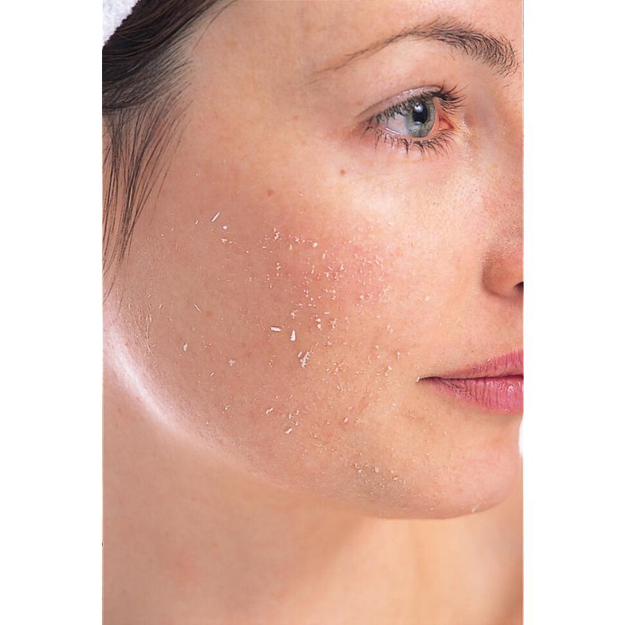 トミーリッチ あかすりアガシ ピーリング 毛穴の黒ずみ 皮脂 角質 透明感 スキンケア ボディケア |  | 01