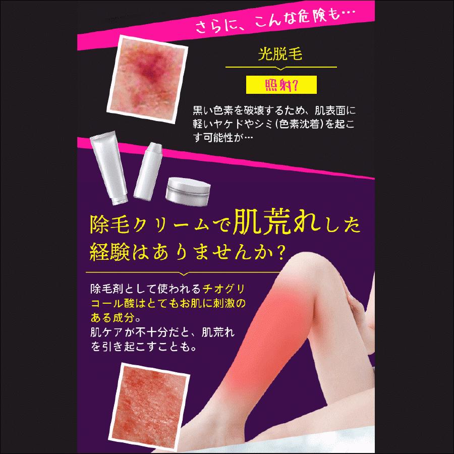 市場 ゼロクリーン 除毛液 腹毛 ムダ毛 腕毛 ワキ毛 無駄毛 薬用除毛クリーム 産毛 髭 スネ毛 剛毛 背毛 多毛 クリーム 除毛剤