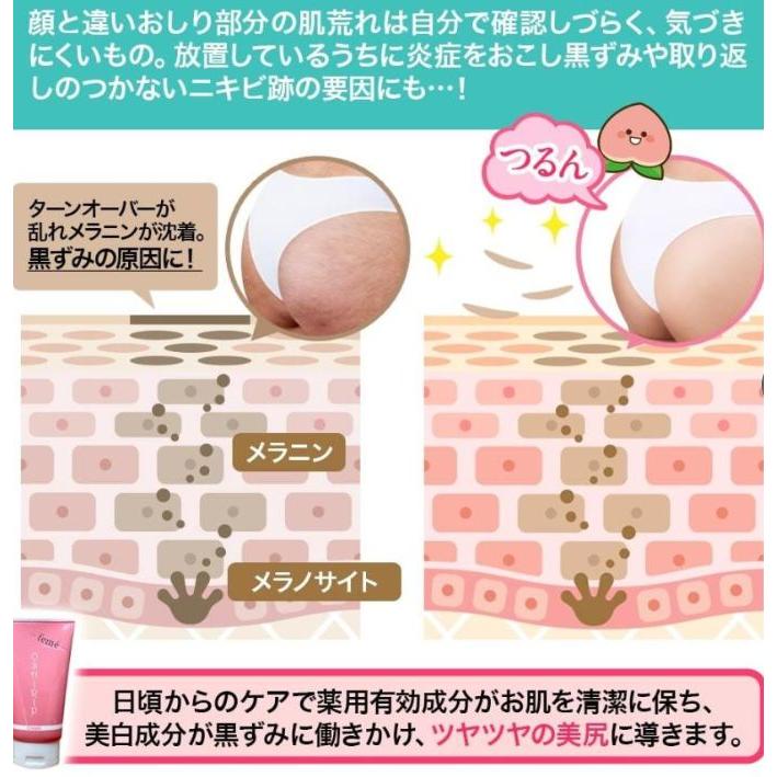 薬用ホワイトニングモイスチュアクリーム おしリップ 60g X9個セット お尻の悩み_6