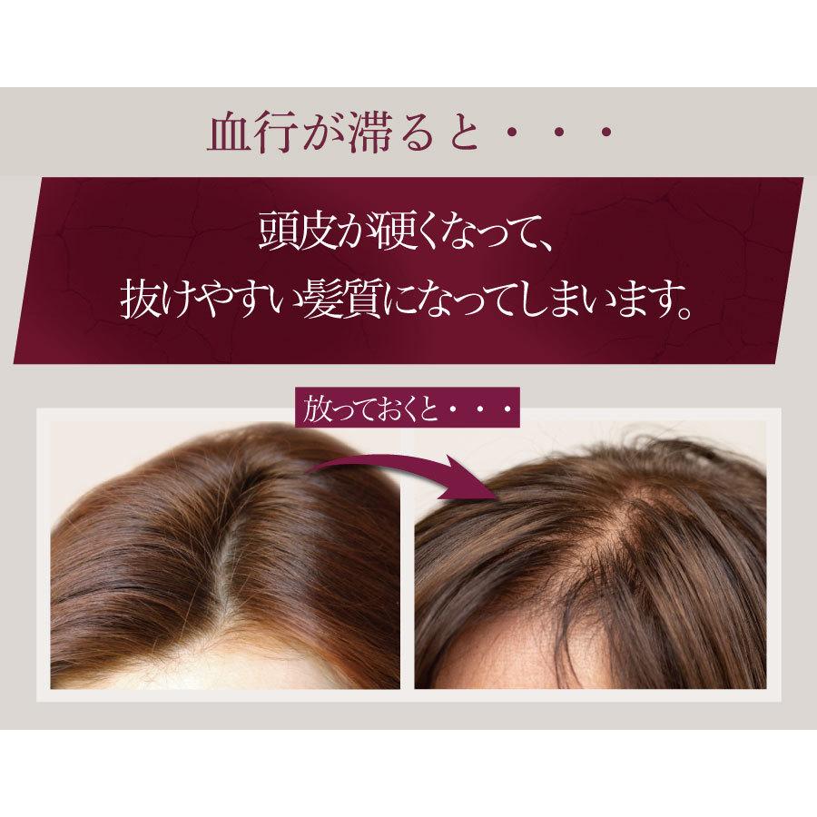 ヘアリシェ HAIRICHE 薬用スカルプエッセンス 育毛剤 送料無料 発毛