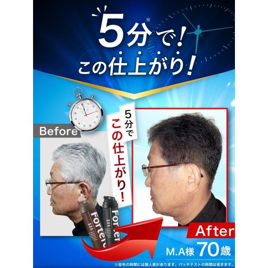 医薬部外品】白髪染め Fortero クイックフォームカラー［ブラック