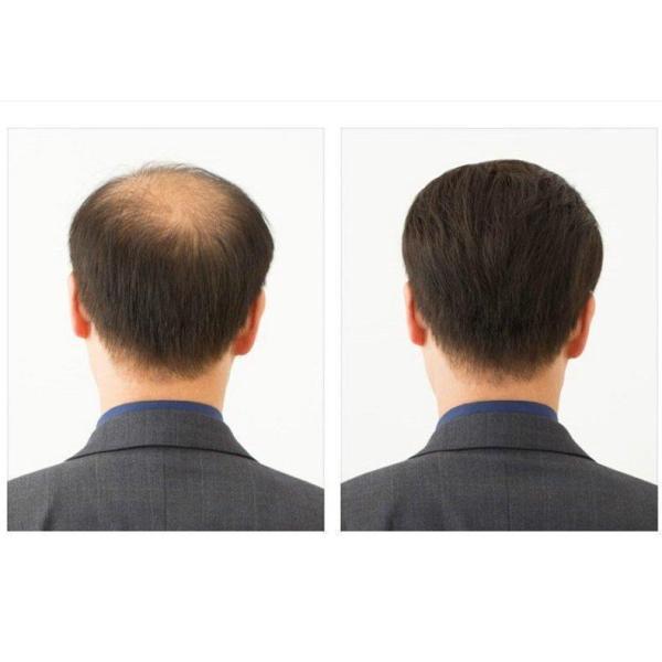 メンズウィッグ フルウィッグ ショートヘア メンズ 男性 男性用 かつら 全頭 ストレート ブラック 中年 シニア ナチュラル 自然の画像