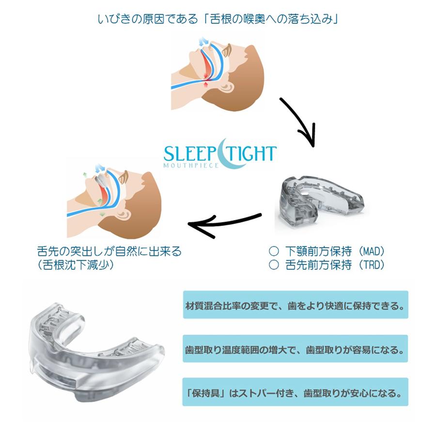 マウスピース 歯ぎしり スリープタイト STZ 保管ケース付 型取り 改良版 いびき対策 いびき軽減 イビキ 就寝 夜間 快眠 SLEEPTIGHT 米国製｜select-mofu-y｜03