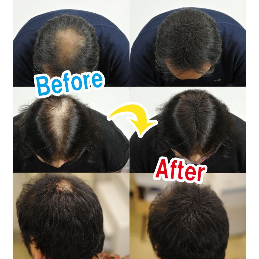 白髪隠し 薄毛隠し 薄毛カバー パウダー マジックパウダー 50g 粉