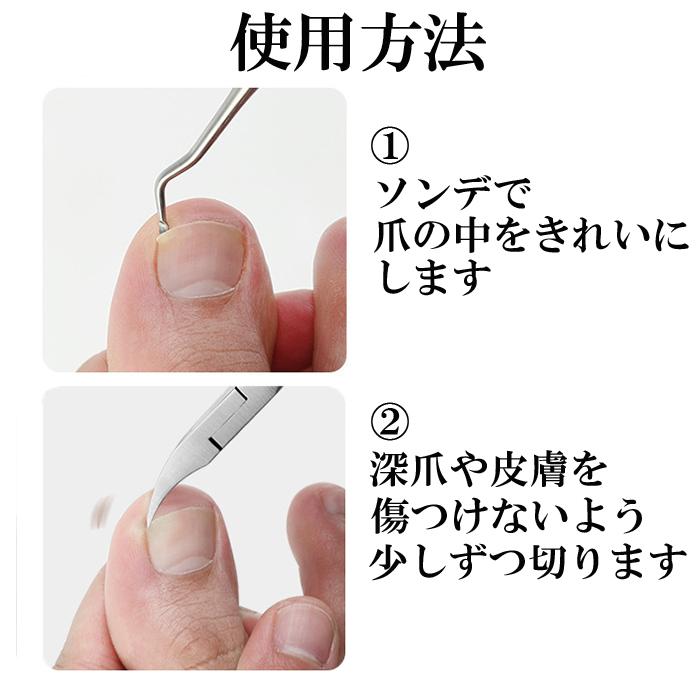 爪切り ニッパー 巻き爪 硬い爪 ステンレス ゾンデ ネイルケア