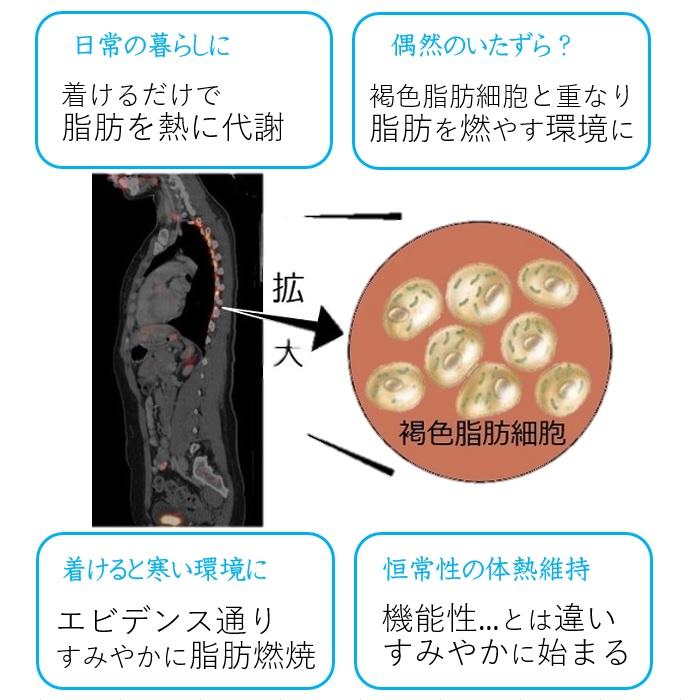 オリジナル品 交感神経 刺激 基礎代謝上げて痩せる仕組を引き出すダイエット器具 背中クールタイ お腹 引き締め即効果 有酸素運動 安静時背中痩せ 中性脂肪落す |  | 07