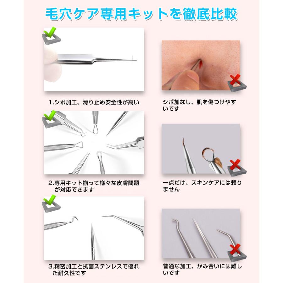 毛穴ケア専用キット 5本セット ケース付き プロ仕様 抗菌ステンレス いちご鼻 黒ずみ 角栓取り 角栓除去 ピンセット スキンケア ニキビ コメドプッシャー 素肌 D Sendoヤフー店 通販 Yahoo ショッピング
