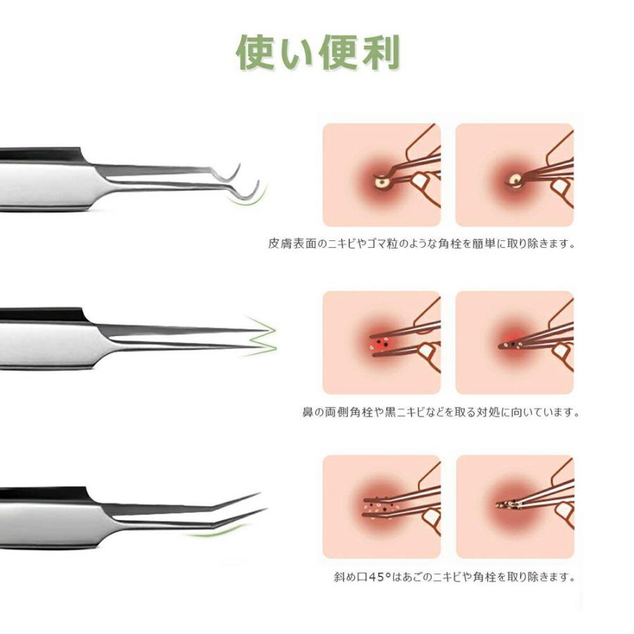 毛穴ケア専用キット 5本セット ケース付き プロ仕様 抗菌ステンレス いちご鼻 黒ずみ 角栓取り 角栓除去 ピンセット スキンケア ニキビ コメドプッシャー 素肌 D Sendoヤフー店 通販 Yahoo ショッピング