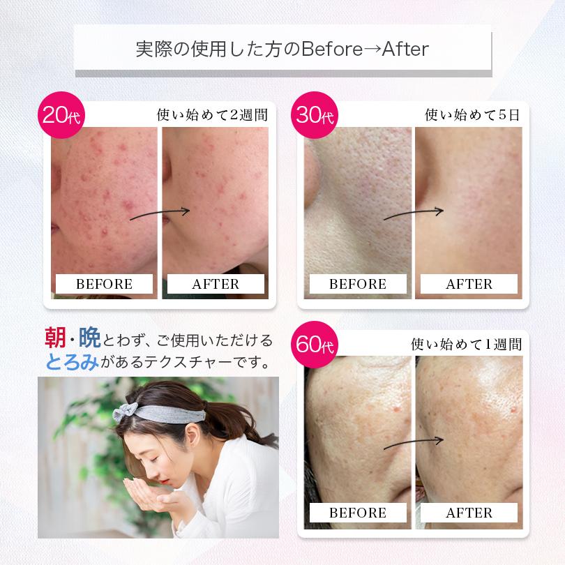 RAW 艶 生プラセンタ 美容液 30ml 送料無料 レターパック 化粧品