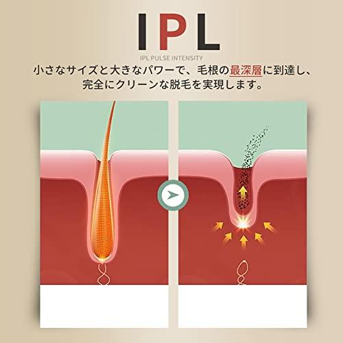 「超メルカリ市」 Benicci 脱毛器 IPL光脱毛器 99万照射 メンズ レディース 無痛脱毛 男女兼用 家庭用脱毛器 5段階自動照射 全身適用 vio 【1854546905】(11071円)