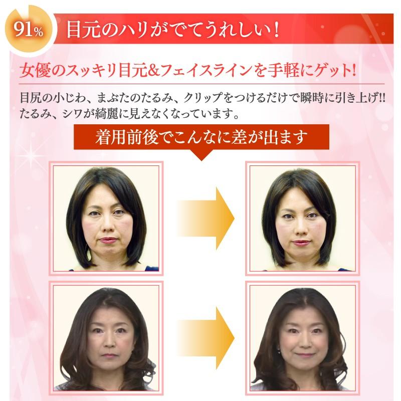 フェイス アップ クリップa 三雲孝江プロデュース 正規販売店 顔のたるみ ほうれい線 小じわを 瞬間解消 メール便 送料無料 Faceupclip1 シャクレイ 通販 Yahoo ショッピング