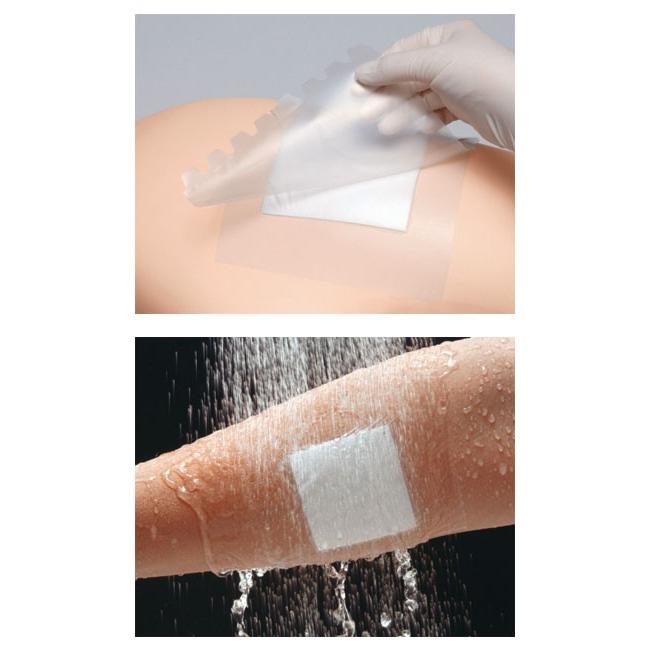 マルチフィックス・ロール　15号 / 17824　幅16cm（アルケア） 介護 医療 防水フィルム 透湿 包帯 固定 薄い 処置 看護 病院 施設 衛生用品 皮膚保護 マルチフィックス・ロール 15号 / 17824  幅16cm【返品不可】 Amazon | アルケア マルチフィックス・ロール 160mm×10m 17824 15号(16cm×10m) 1巻 |  アルケア(Alcare) | 絆創膏