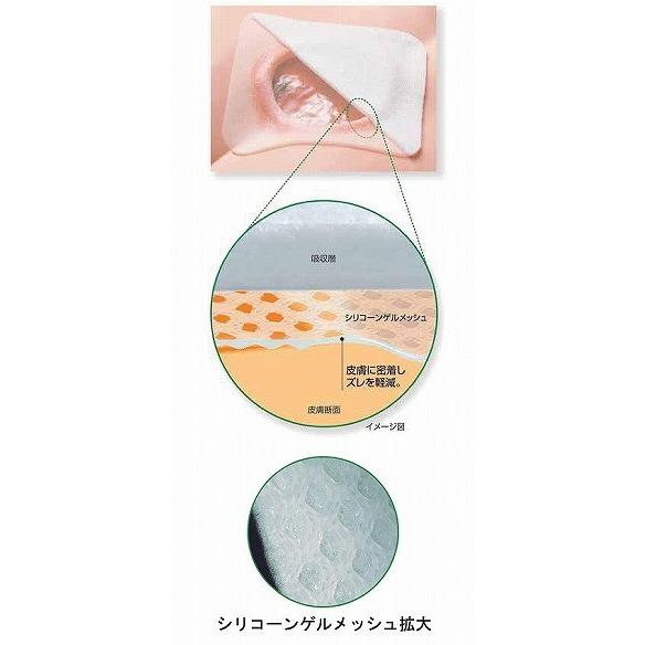 エスアイエイド 5号 / 18762 10×10cm 3枚入（アルケア） : 介護用品の