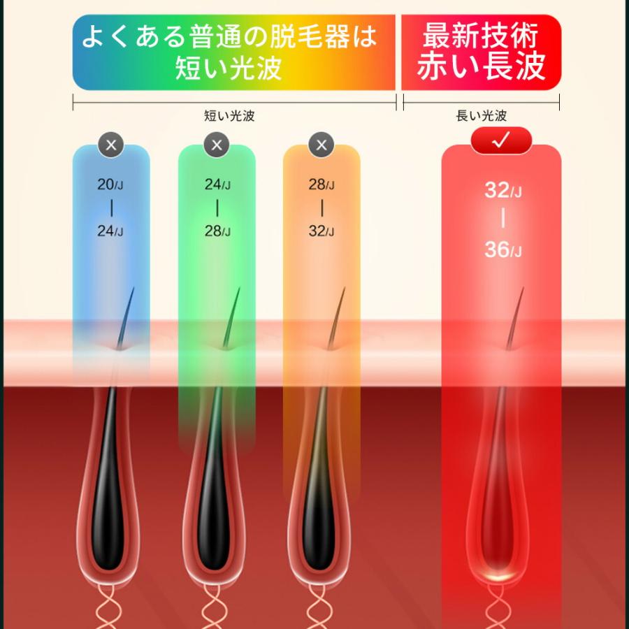 脱毛器 IPL光脱毛器 冷感脱毛器 90万発照射 自動/手動照射 5段階調整