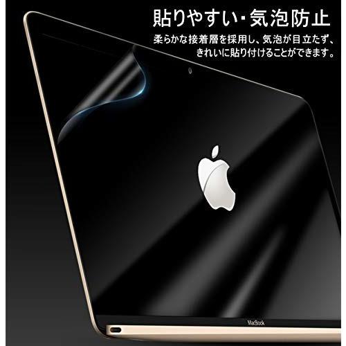 14 6インチ 16 9用 ブルーライトカットフィルム Pet製 超薄 高透過率 14 6インチフィルム 14 6インチ 液晶保護フィ 12038709352 しもやな商店 通販 Yahoo ショッピング