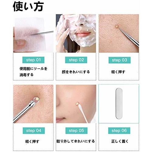 Irong 毛抜き 角栓取り毛穴ケア ピンセット アクネプッシャーキット ニキビ取り 黒ずみ取り 角栓 いちご 鼻ケ しもやな商店 通販 Yahoo ショッピング