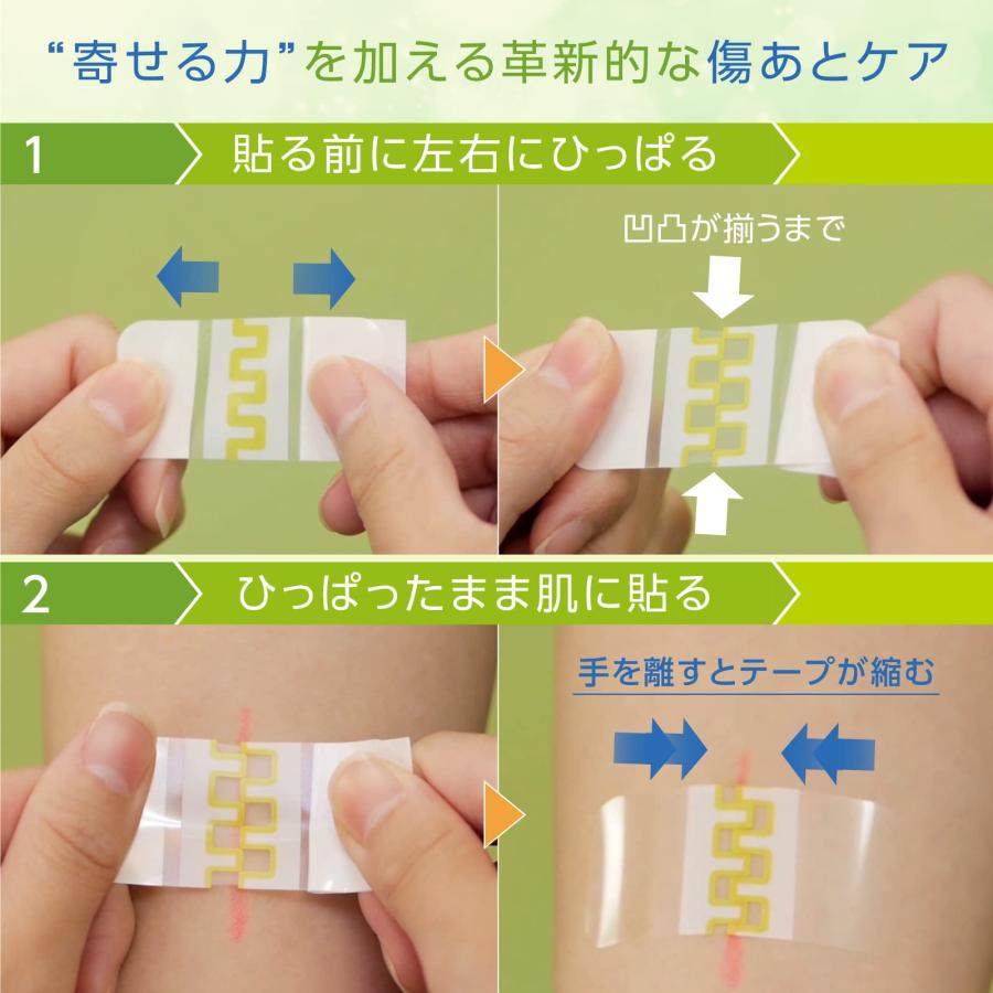 skinix(スキニックス) アトレスケア 傷あとケア専用テープ 25×50mm 30