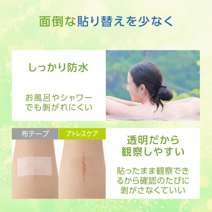 skinix アトレスケア 傷あとケア専用テープ 50×50mm 30枚入 帝王切開